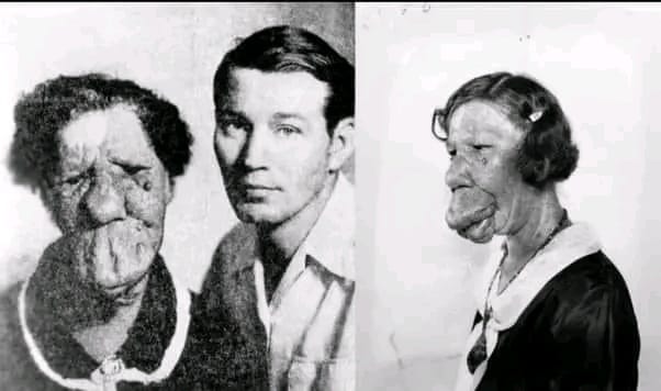 The Inspiring Story of Grace McDaniels, the "Mule-Faced Woman"